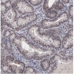 RNA Polymerase II Subunit F (POLR2F) Antibody