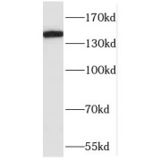 WB analysis of MCF7 cells, using POLR3A antibody (1/300 dilution).