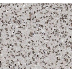 RNA Polymerase III Subunit K (POLR3K) Antibody