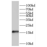 WB analysis of HeLa cells, using POMP antibody (1/2000 dilution).