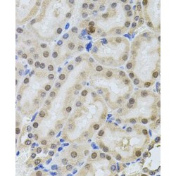 POP4 Homolog, Ribonuclease P/MRP Subunit (POP4) Antibody