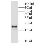 WB analysis of HeLa cells, using POP7 antibody (1/600 dilution).