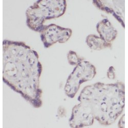 Popeye Domain Containing 3 (POPDC3) Antibody