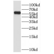 WB analysis of COLO 320 cells, using POPDC3 antibody (1/1000 dilution).