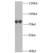 WB analysis of HeLa cells, using POT1 antibody (1/1000 dilution).