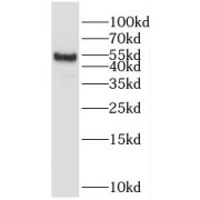 WB analysis of human testis tissue, using POTEA antibody (1/300 dilution).