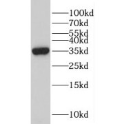 WB analysis of mouse lung tissue, using POU2AF1 antibody (1/500 dilution).