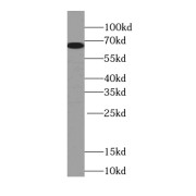 WB analysis of SH-SY5Y cells, using POU3F3-Specific antibody (1/1000 dilution).