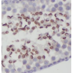 PP2A Antibody