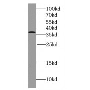 WB analysis of HEK-293 cells, using PP2A antibody (1/500 dilution).