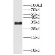 WB analysis of human heart tissue, using PPA1 antibody (1/500 dilution).