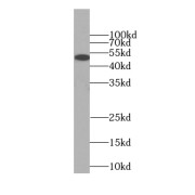 WB analysis of COLO 320 cells, using PPARD antibody (1/1000 dilution).