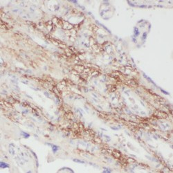 PPBP,NAP2 Antibody