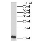 WB analysis of mouse liver tissue, using PPBP antibody (1/300 dilution).