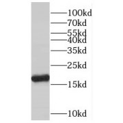 WB analysis of PC-3 cells, using PPIH antibody (1/200 dilution).