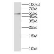 WB analysis of MCF7 cells, using PPM1B antibody (1/400 dilution).