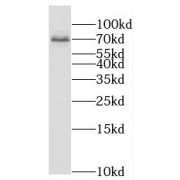 WB analysis of mouse lung tissue, using PPM1G antibody (1/800 dilution).