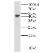 WB analysis of human brain tissue, using PPM1K antibody (1/500 dilution).