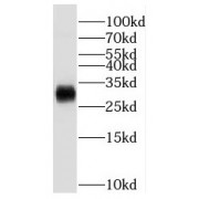 WB analysis of human lung tissue, using PPM1M antibody (1/500 dilution).