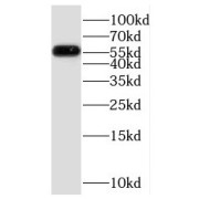 WB analysis of PC-3 cells, using PPM2C antibody (1/600 dilution).