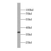 WB analysis of human brain tissue, using PPP1CB antibody (1/1500 dilution).