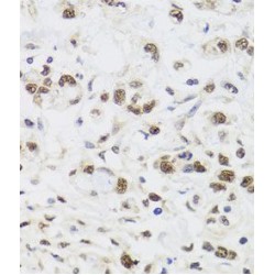 Protein Phosphatase 1 Catalytic Subunit Gamma (PPP1CC) Antibody