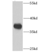 WB analysis of MCF7 cells, using PPP1CC antibody (1/1000 dilution).