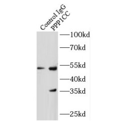 Protein Phosphatase 1 Catalytic Subunit Gamma (PPP1CC) Antibody