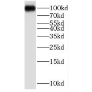 WB analysis of HepG2 cells, using PPP1R10 antibody (1/300 dilution).