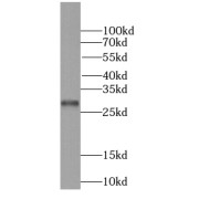 WB analysis of HeLa cells, using PPP1R11-Specific antibody (1/200 dilution).