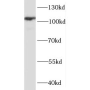 WB analysis of mouse heart tissue, using PPP1R12B antibody (1/10000 dilution).