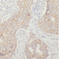 RelA-Associated Inhibitor (PPP1R13L) Antibody