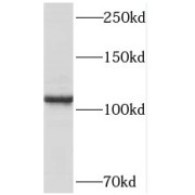 WB analysis of human heart tissue, using PPP1R13L antibody (1/200 dilution).