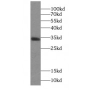 WB analysis of human testis tissue, using PPP1R2P9 antibody (1/300 dilution).