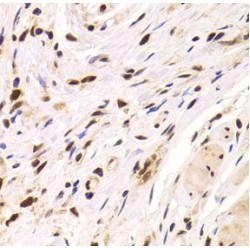 Protein Phosphatase 1 Regulatory Subunit 8 (PPP1R8) Antibody