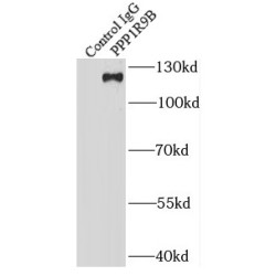 Neurabin-2 (PPP1R9B) Antibody