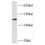 WB analysis of mouse brain tissue, using PPP1R9B antibody (1/500 dilution).