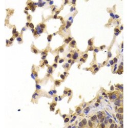 Protein Phosphatase 2 Scaffold Subunit A Beta (PPP2R1B) Antibody