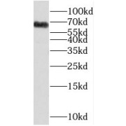 WB analysis of HL-60 cells, using PPP2R3B antibody (1/1000 dilution).