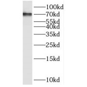 WB analysis of Y79 cells, using PPP2R5D antibody (1/400 dilution).