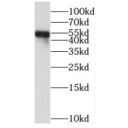 WB analysis of HeLa cells, using PPP2R5E antibody (1/1000 dilution).