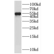 WB analysis of A549 cells, using PPP3CA antibody (1/1000 dilution).