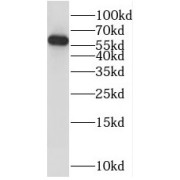 WB analysis of human heart tissue, using PPP3CB antibody (1/400 dilution).