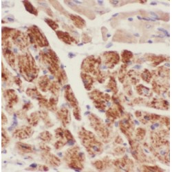 Protein Phosphatase 3 Catalytic Subunit Beta (PPP3CB) Antibody