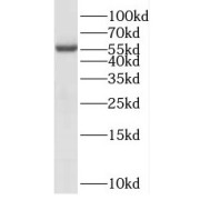 WB analysis of mouse testis tissue, using PPP3CC antibody (1/500 dilution).