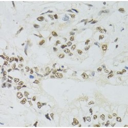 Protein Phosphatase 4 Catalytic Subunit (PPP4C) Antibody