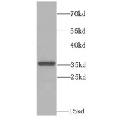 WB analysis of MCF7 cells, using PPP4C antibody (1/1000 dilution).