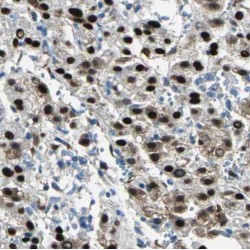 Protein Phosphatase 4 Regulatory Subunit 2 (PPP4R2) Antibody