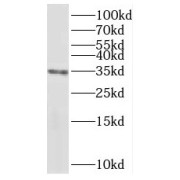 WB analysis of mouse testis tissue, using PPP6C antibody (1/1000 dilution).