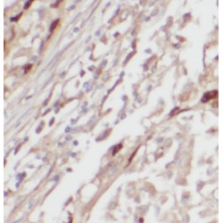 Prolylcarboxypeptidase (PRCP) Antibody